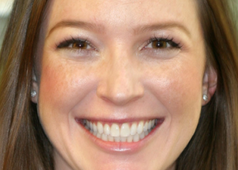 Case becca after query